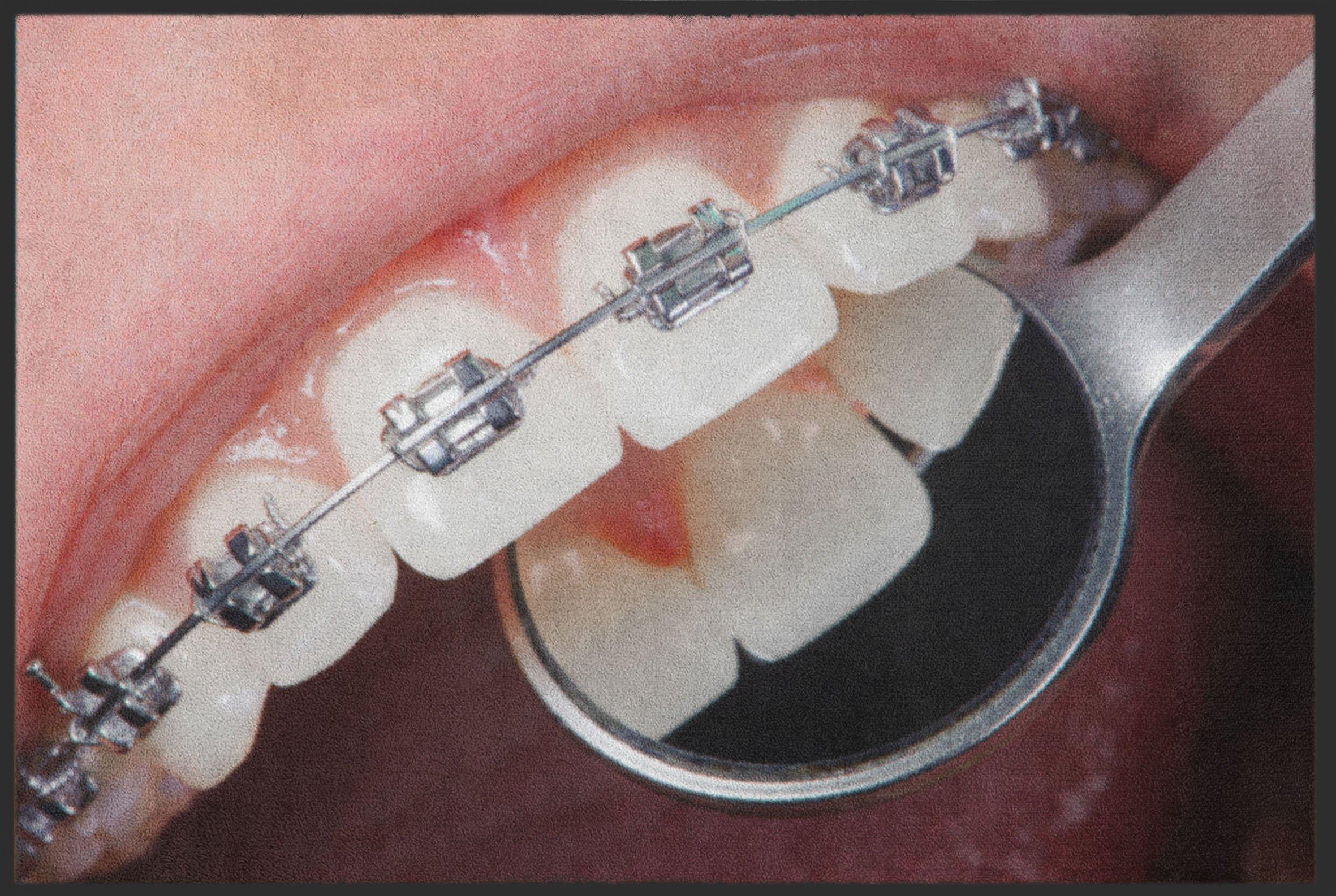 Fussmatte  Kieferorthopäde 6146
